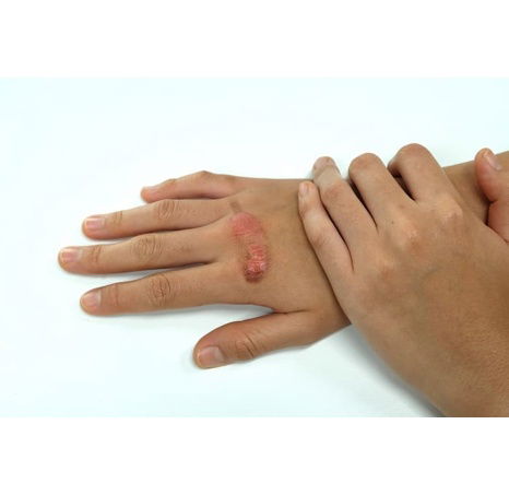 REPOLAR Abilar® balzám na rány 20g